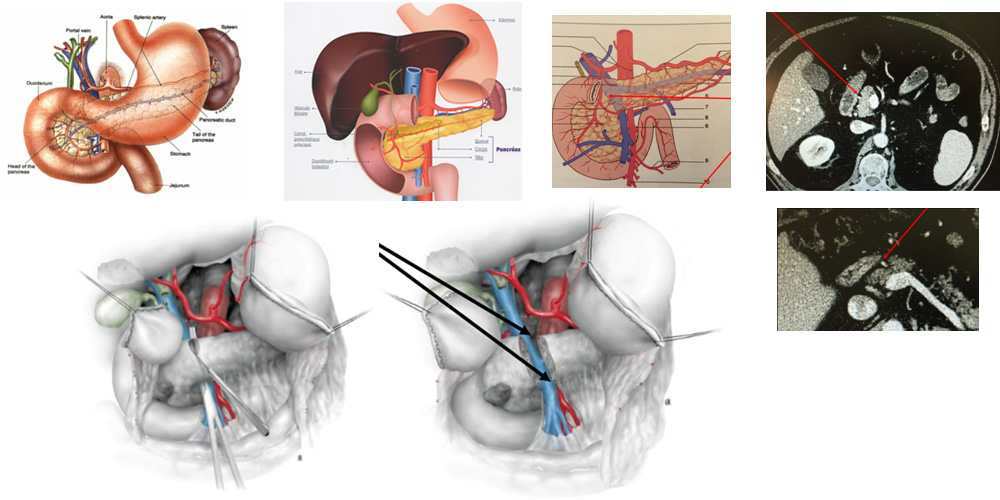 anatomie complexe