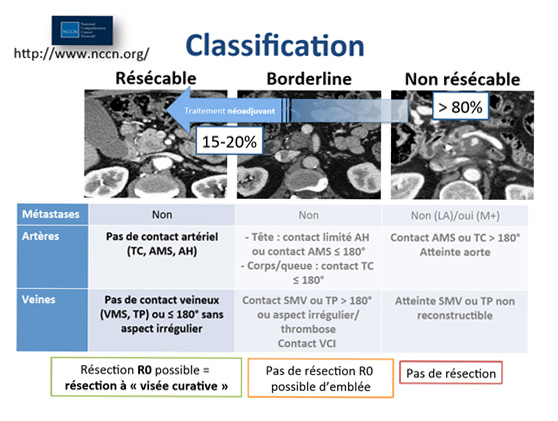 Qu'est-ce que le cancer du Pancréas ? | Centre Chirugical Lyon Mermoz