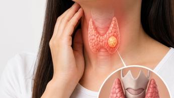 thyroïde
